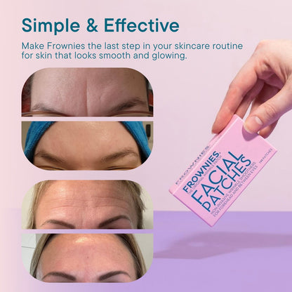 Frownies Forehead & Between the Eyes Wrinkle Patches (144 Count) – Overnight Non-Comedogenic Patches to Smooth Forehead & Eleven Lines, 3 Pack Avelisse