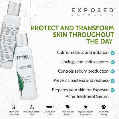 Exposed Skin Care Clearing Tonic Facial Toner – 1% Salicylic Acid & Witch Hazel for Acne, Blackheads & Oily Skin – Natural, Non-Toxic, Cruelty Free Avelisse