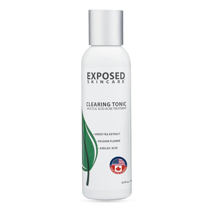 Exposed Skin Care Clearing Tonic Facial Toner – 1% Salicylic Acid & Witch Hazel for Acne, Blackheads & Oily Skin – Natural, Non-Toxic, Cruelty Free Avelisse