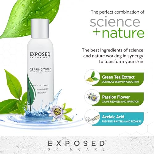Exposed Skin Care Clearing Tonic Facial Toner – 1% Salicylic Acid & Witch Hazel for Acne, Blackheads & Oily Skin – Natural, Non-Toxic, Cruelty Free Avelisse
