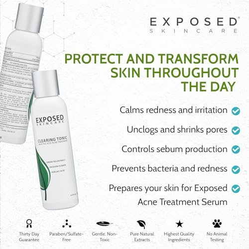 Exposed Skin Care Clearing Tonic Facial Toner – 1% Salicylic Acid & Witch Hazel for Acne, Blackheads & Oily Skin – Natural, Non-Toxic, Cruelty Free Avelisse
