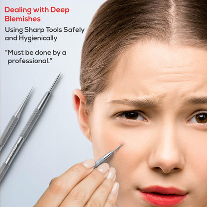 Suvorna Pimple Popper Tool Kit – 4-Piece Stainless Steel Blackhead & Comedone Extractor Set for Facial Extraction Avelisse