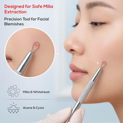 Suvorna Pimple Popper Tool Kit – 4-Piece Stainless Steel Blackhead & Comedone Extractor Set for Facial Extraction Avelisse