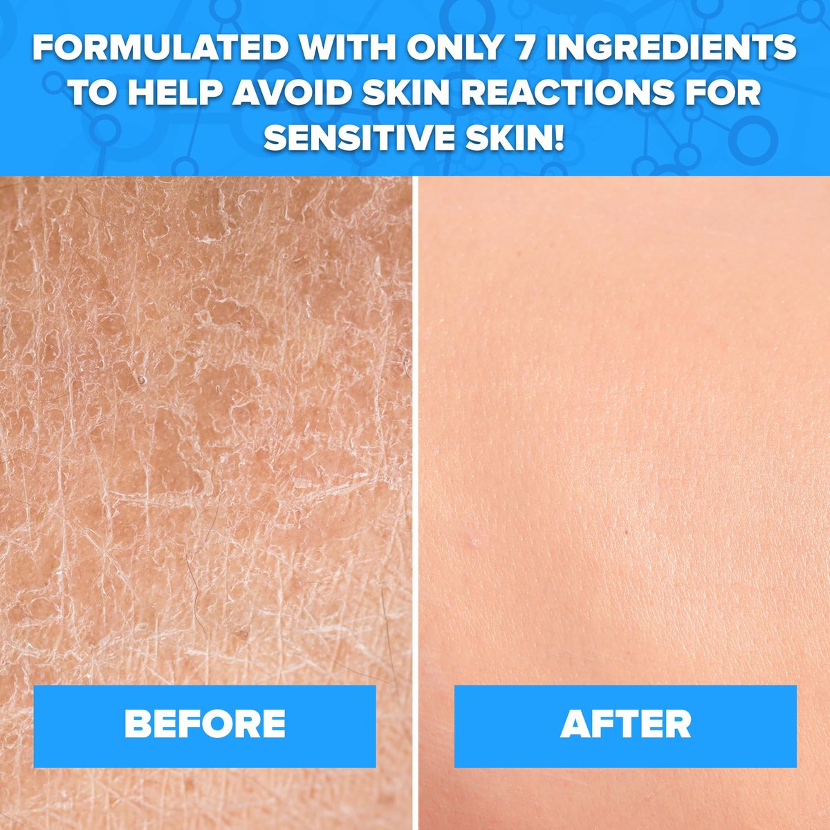 Aquanil Cleanser - Lipid-Free Sensitive Skin Cleanser, Non-Comedogenic Gentle Cleanser - Soap Free Cleanser with 7 Ingredients, Fragrance-Free Skin Care Cleanser - 3 Pack, 16 Fl. Oz. Avelisse