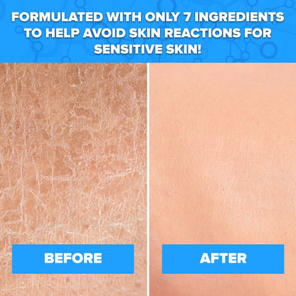 Aquanil Cleanser - Lipid-Free Sensitive Skin Cleanser, Non-Comedogenic Gentle Cleanser - Soap Free Cleanser with 7 Ingredients, Fragrance-Free Skin Care Cleanser - 3 Pack, 16 Fl. Oz. Avelisse