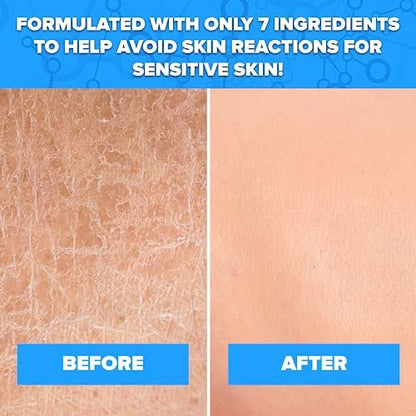 Aquanil Cleanser - Lipid-Free Sensitive Skin Cleanser, Non-Comedogenic Gentle Cleanser - Soap Free Cleanser with 7 Ingredients, Fragrance-Free Skin Care Cleanser - 3 Pack, 16 Fl. Oz. Avelisse