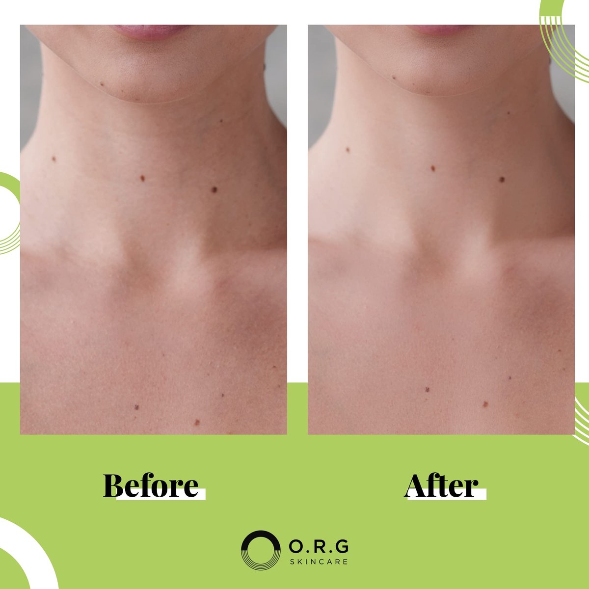 O.R.G. Skincare Mineral Peel Body Scrub - Deep Exfoliating Gel for Glowing & Smooth Skin, 6 oz Avelisse