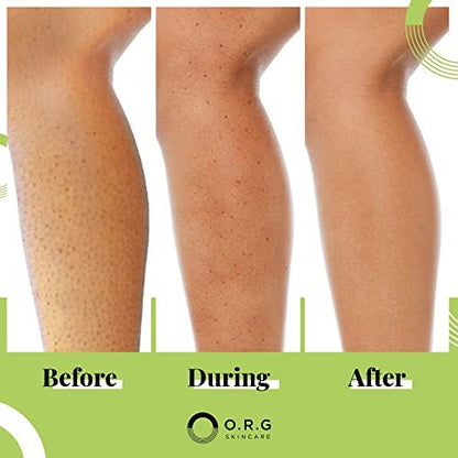O.R.G. Skincare Mineral Peel Body Scrub - Deep Exfoliating Gel for Glowing & Smooth Skin, 6 oz Avelisse