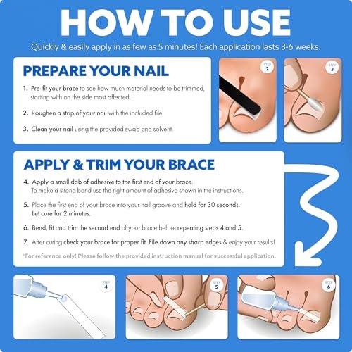 CurveCorrect Ingrown Toenail Treatment Kit – 10 Clear Braces for Pain Relief & Curved Toe Correction Avelisse