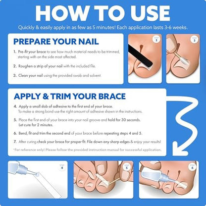 CurveCorrect Ingrown Toenail Treatment Kit – 10 Clear Braces for Pain Relief & Curved Toe Correction Avelisse