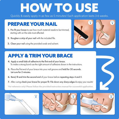 CurveCorrect Ingrown Toenail Treatment Kit – 10 Clear Braces for Pain Relief & Curved Toe Correction Avelisse