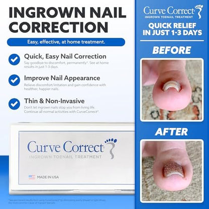 CurveCorrect Ingrown Toenail Treatment Kit – 10 Clear Braces for Pain Relief & Curved Toe Correction Avelisse