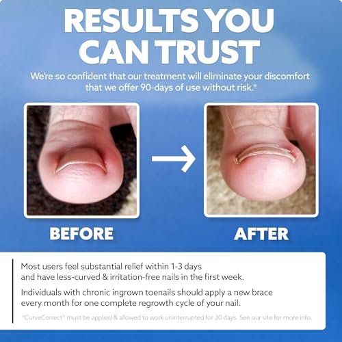 CurveCorrect Ingrown Toenail Treatment Kit – 10 Clear Braces for Pain Relief & Curved Toe Correction Avelisse