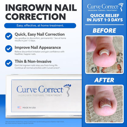 CurveCorrect Ingrown Toenail Treatment Kit – 10 Clear Braces for Pain Relief & Curved Toe Correction Avelisse