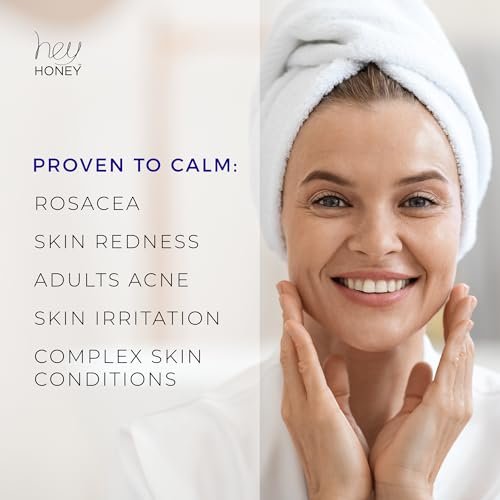 Hey Honey Skincare Relax - Instant Rosacea Relief Cream for Sensitive Skin | Calming Face Moisturizer for Facial Redness & Irritation | Dermatologist Tested, Oil-Free with Honey & Propolis | 2.2 Oz Avelisse