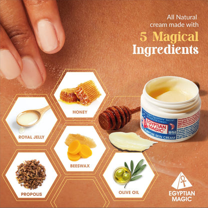 Egyptian Magic All Purpose Skin Cream – 2 oz Jar for Face, Body, Eczema, Scars, Stretch Marks & Tattoo Aftercare