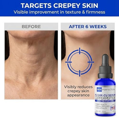 Skin Perfection GHK-CU Copper Peptides Serum for Face & Hair - 1% Blue Liquid Multi-Use Serum Booster with Dropper 0.5 fl oz Avelisse