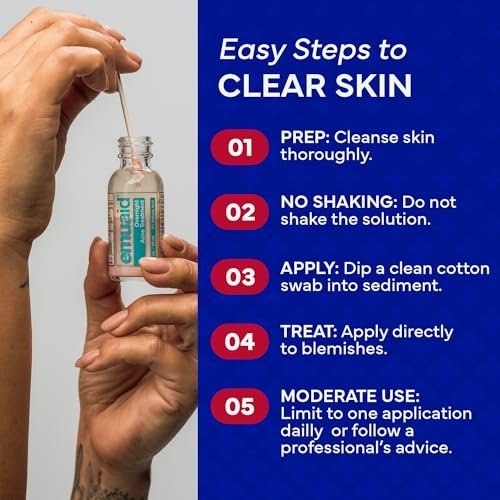 EMUAID Overnight Acne Treatment with Salicylic Acid - Gentle Fast-Acting Solution for Adults & Teens, Clears Stubborn Pimples, Cystic Acne, Blackheads, Rosacea, and Hormonal Breakouts (1 oz) Avelisse