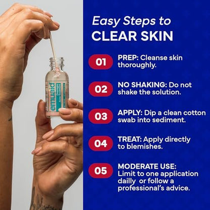 EMUAID Overnight Acne Treatment with Salicylic Acid - Gentle Fast-Acting Solution for Adults & Teens, Clears Stubborn Pimples, Cystic Acne, Blackheads, Rosacea, and Hormonal Breakouts (1 oz) Avelisse