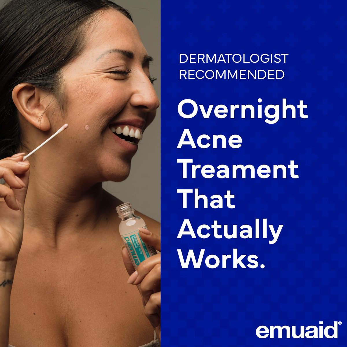 EMUAID Overnight Acne Treatment with Salicylic Acid - Gentle Fast-Acting Solution for Adults & Teens, Clears Stubborn Pimples, Cystic Acne, Blackheads, Rosacea, and Hormonal Breakouts (1 oz) Avelisse