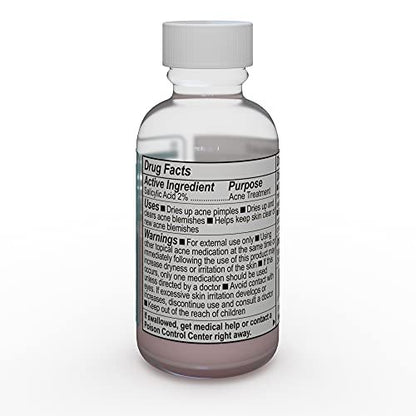 EMUAID Overnight Acne Treatment with Salicylic Acid - Gentle Fast-Acting Solution for Adults & Teens, Clears Stubborn Pimples, Cystic Acne, Blackheads, Rosacea, and Hormonal Breakouts (1 oz) Avelisse