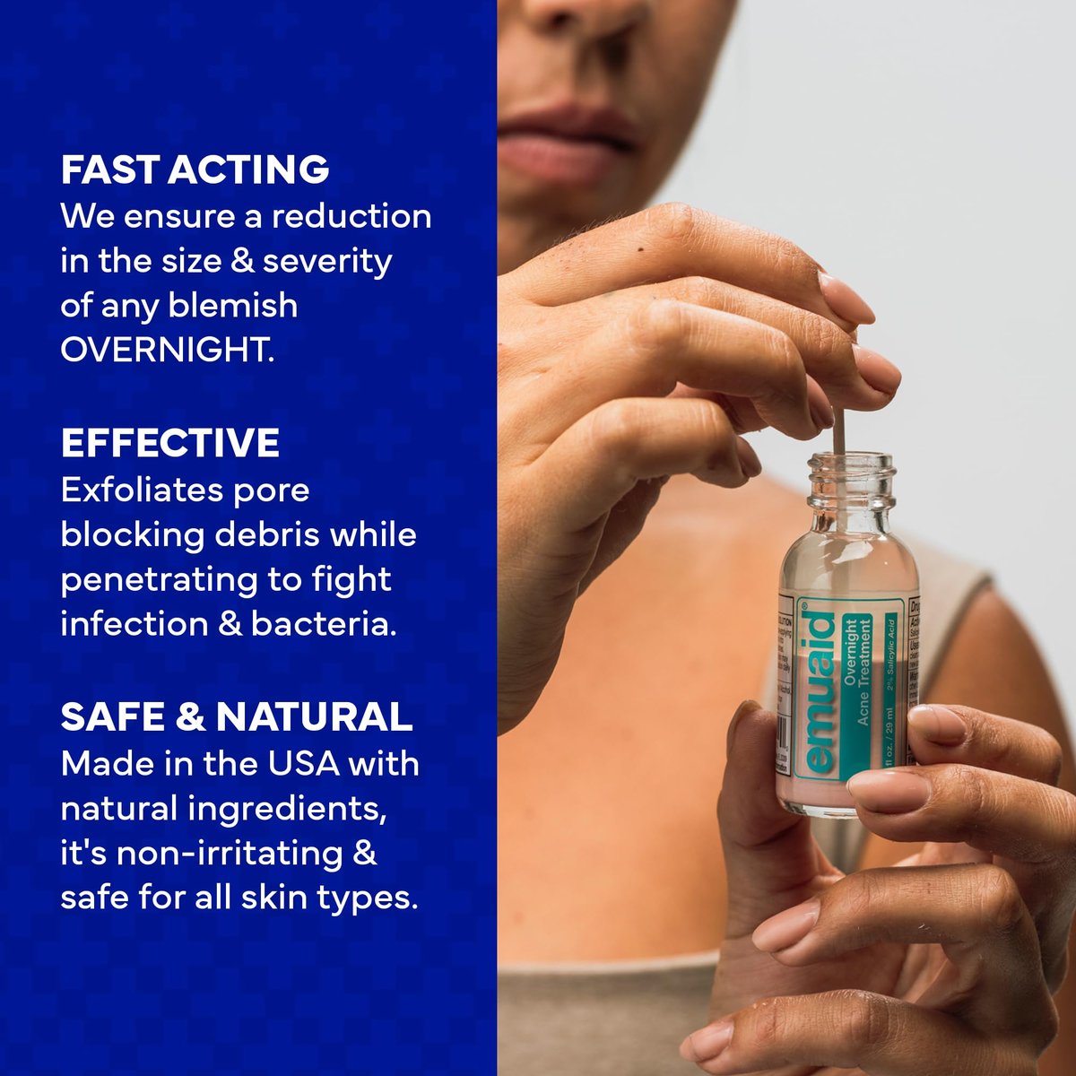 EMUAID Overnight Acne Treatment with Salicylic Acid - Gentle Fast-Acting Solution for Adults & Teens, Clears Stubborn Pimples, Cystic Acne, Blackheads, Rosacea, and Hormonal Breakouts (1 oz) Avelisse