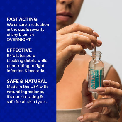 EMUAID Overnight Acne Treatment with Salicylic Acid - Gentle Fast-Acting Solution for Adults & Teens, Clears Stubborn Pimples, Cystic Acne, Blackheads, Rosacea, and Hormonal Breakouts (1 oz) Avelisse