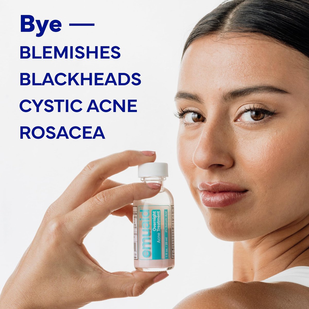 EMUAID Overnight Acne Treatment with Salicylic Acid - Gentle Fast-Acting Solution for Adults & Teens, Clears Stubborn Pimples, Cystic Acne, Blackheads, Rosacea, and Hormonal Breakouts (1 oz) Avelisse