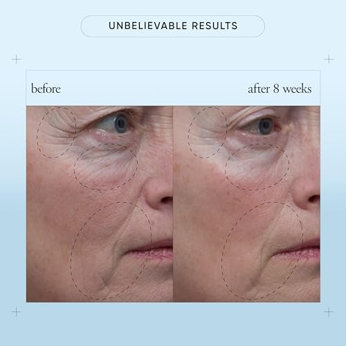 philosophy when hope is not enough facial firming serum - with vitamins C, E & hyaluronic acid - revitalizes dull complexion while reducing the look of fine lines and wrinkles - 1 fl oz Avelisse