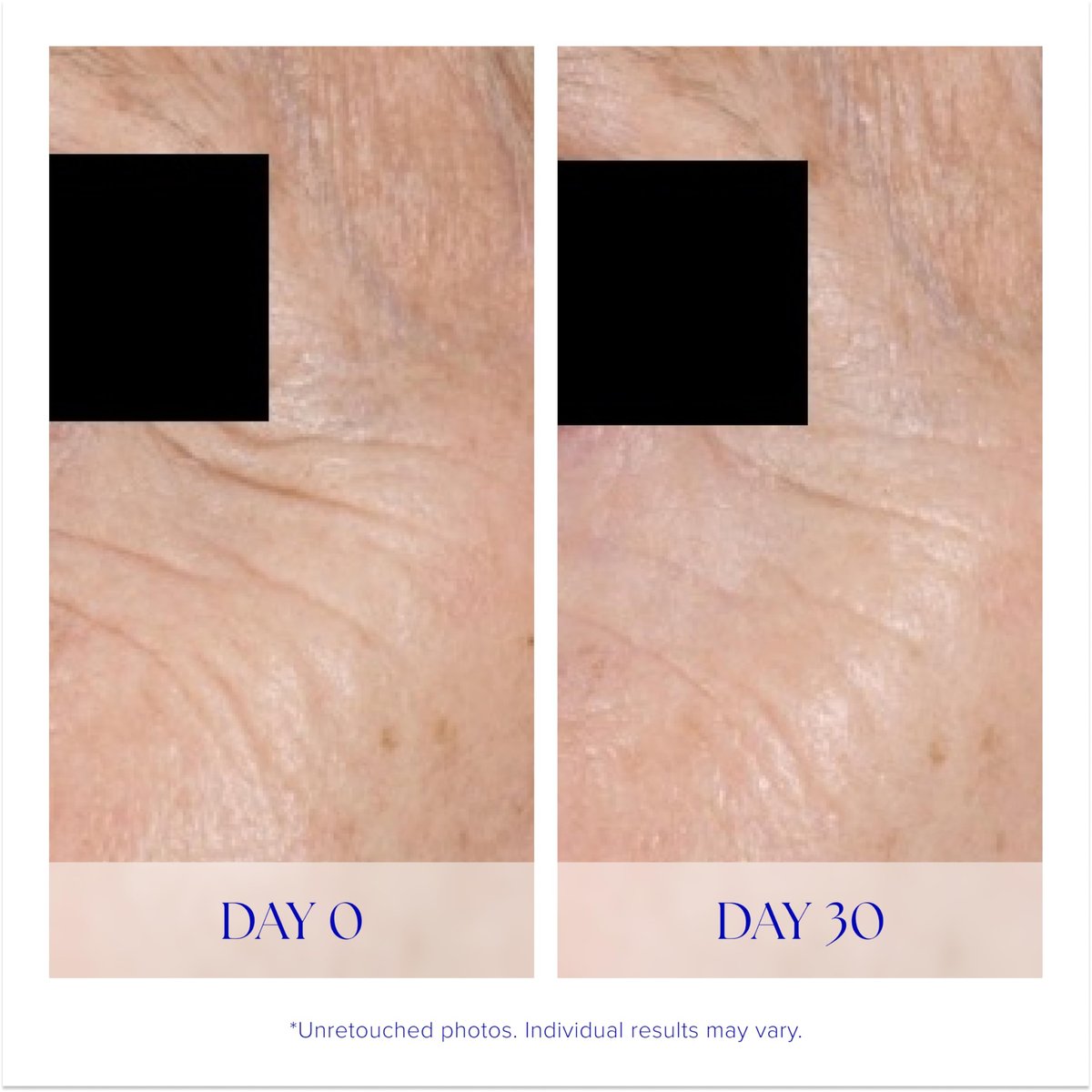 iS CLINICAL Youth Eye Complex – Anti-Aging Under Eye Cream for Dark Circles, Puffiness & Hydration Avelisse