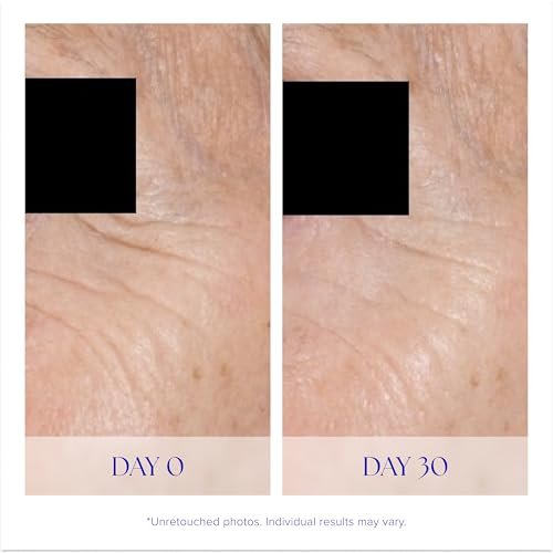 iS CLINICAL Youth Eye Complex – Anti-Aging Under Eye Cream for Dark Circles, Puffiness & Hydration Avelisse