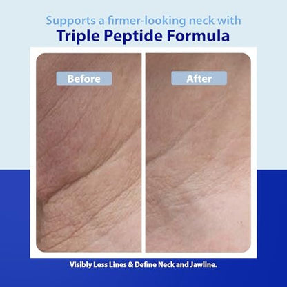 Dr. Denese Triple Strength Neck Wrinkle Smoother 4 oz – Firming Cream with Peptides, Retinol & Hyaluronic Acid Avelisse
