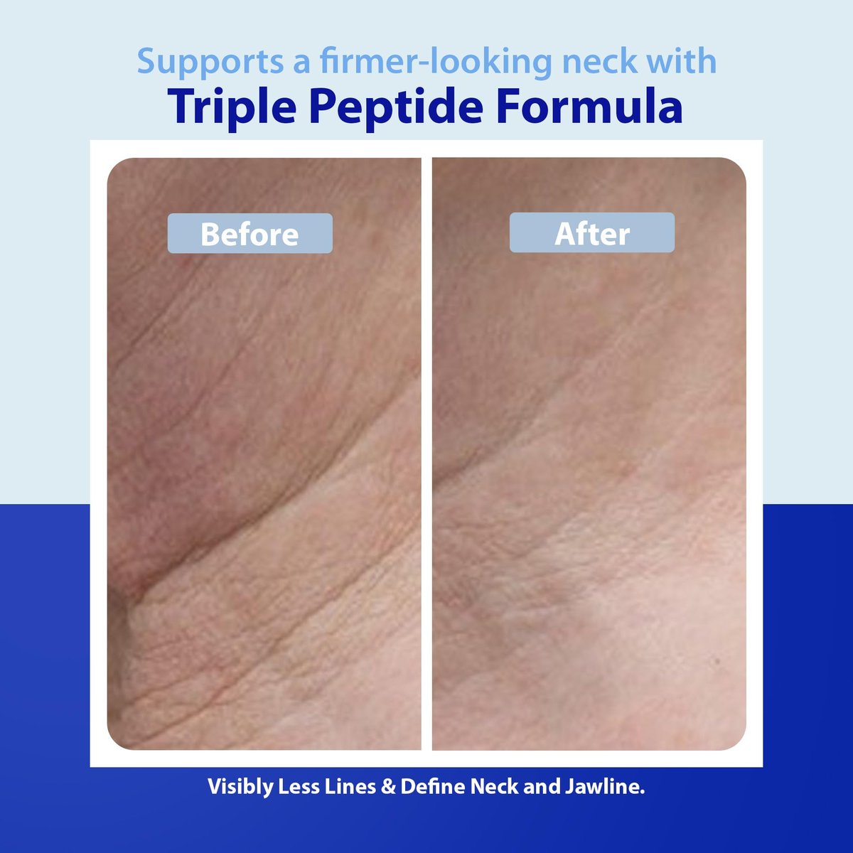 Dr. Denese Triple Strength Neck Wrinkle Smoother 4 oz – Firming Cream with Peptides, Retinol & Hyaluronic Acid Avelisse