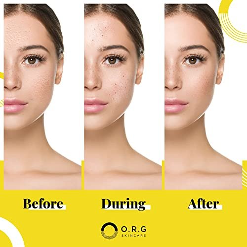 ORG Peel Off Face Cleanser – Gentle Exfoliating Korean Sensitive Skincare for Glowing Skin, Pore Minimizer & Brightening Agent, Cruelty Free Natural Formula, 2 oz Avelisse