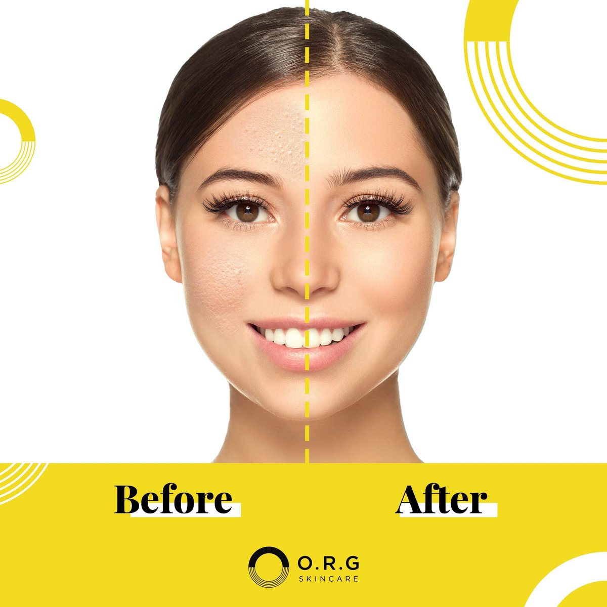 ORG Peel Off Face Cleanser – Gentle Exfoliating Korean Sensitive Skincare for Glowing Skin, Pore Minimizer & Brightening Agent, Cruelty Free Natural Formula, 2 oz Avelisse