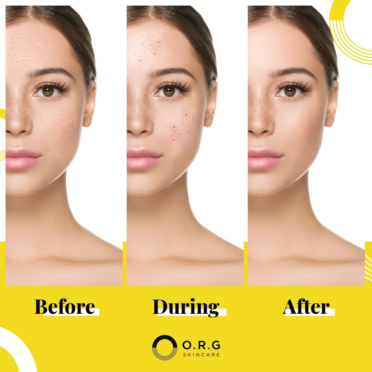 ORG Peel Off Face Cleanser – Gentle Exfoliating Korean Sensitive Skincare for Glowing Skin, Pore Minimizer & Brightening Agent, Cruelty Free Natural Formula, 2 oz Avelisse