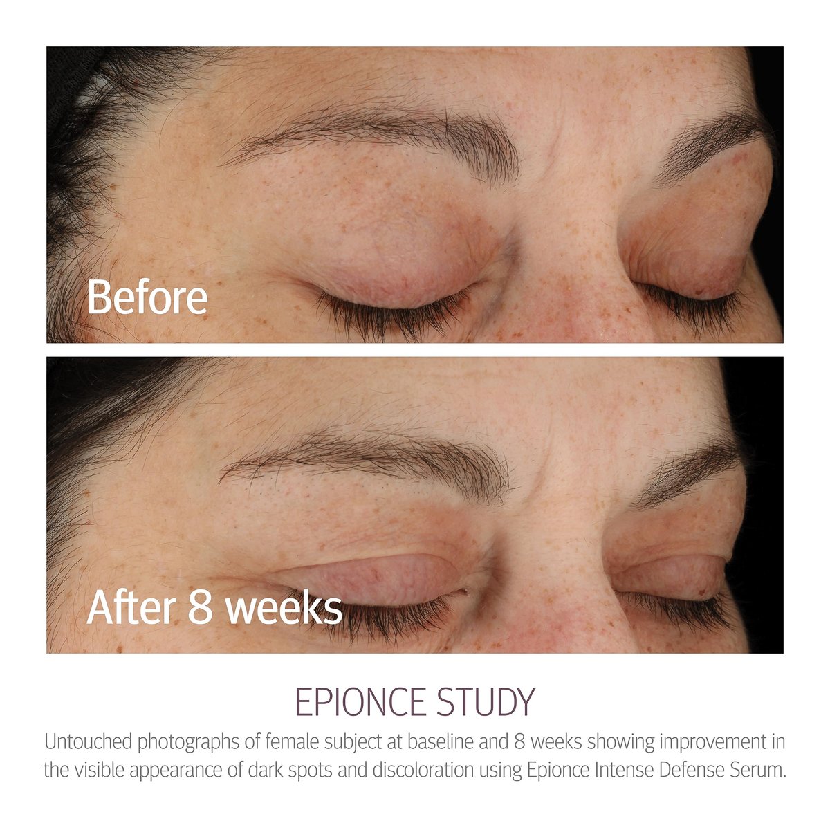 Epionce Intense Defense Serum – Anti-Aging Facial Serum with Vitamin C, E, D, A, B & Niacinamide | Dermatologist-Developed Skincare Avelisse