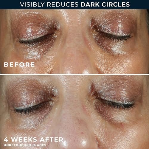 RoC Multi Correxion 5 in 1 Anti-Aging Eye Cream for Puffiness, Under Eye Bags & Dark Circles - 0.5 oz with Night Cream Packette Avelisse