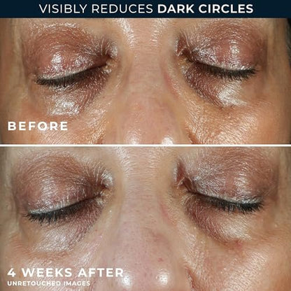 RoC Multi Correxion 5 in 1 Anti-Aging Eye Cream for Puffiness, Under Eye Bags & Dark Circles - 0.5 oz with Night Cream Packette Avelisse
