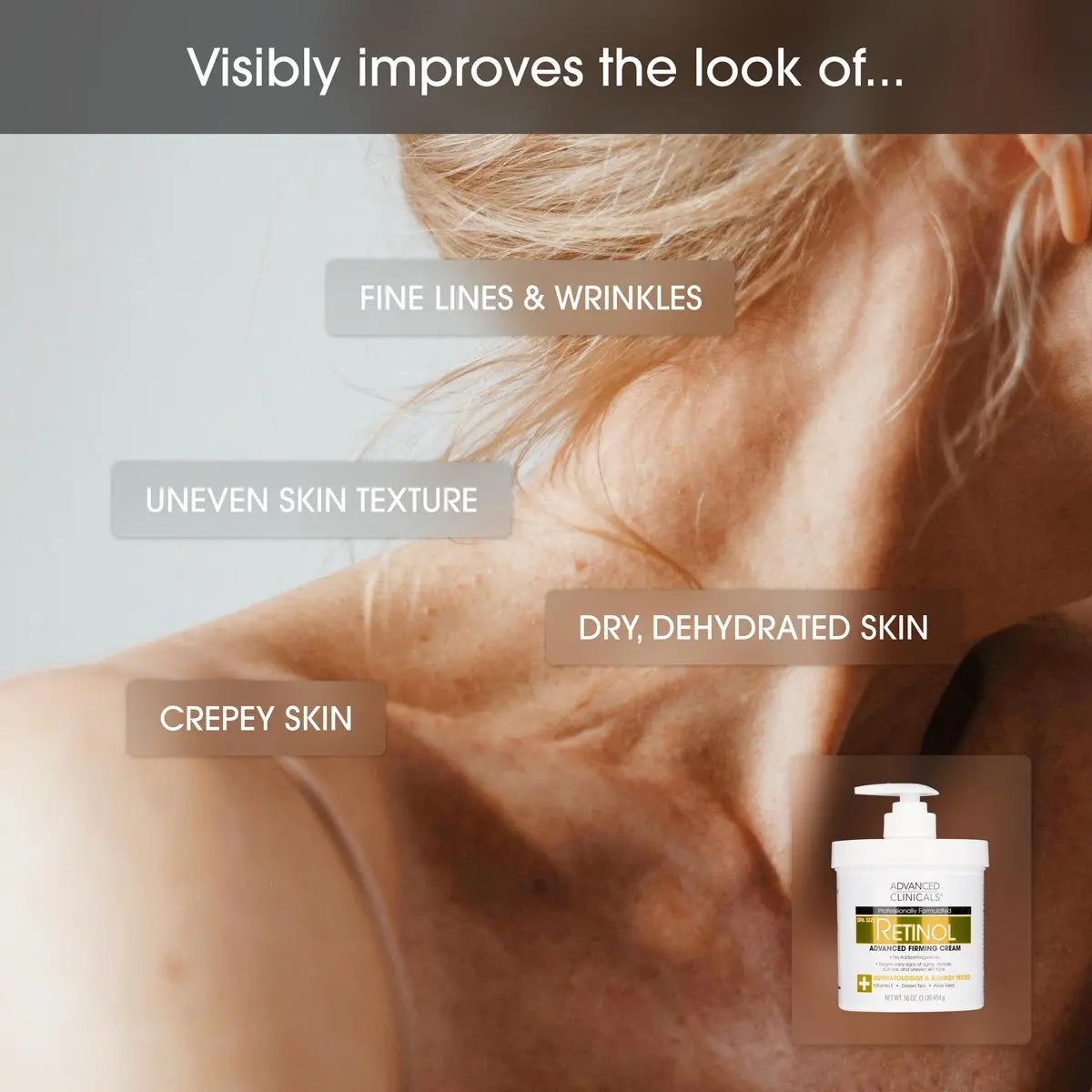 Advanced Clinicals Retinol Body Lotion & Face Moisturizer - Anti Aging Cream for Fine Lines, Wrinkles & Crepe Skin, 16 oz Avelisse