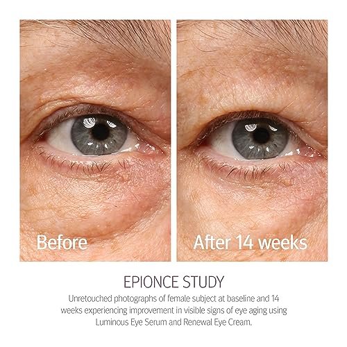 Epionce Renewal Eye Cream – Anti-Aging Under Eye Cream for Dark Circles, Fine Lines, Wrinkles & Puffiness with Hyaluronic Acid, All Skin Types, Dermatologist Skincare Avelisse