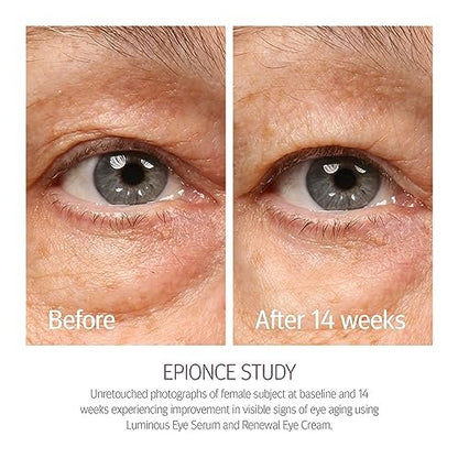 Epionce Renewal Eye Cream – Anti-Aging Under Eye Cream for Dark Circles, Fine Lines, Wrinkles & Puffiness with Hyaluronic Acid, All Skin Types, Dermatologist Skincare Avelisse