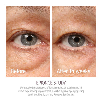 Epionce Renewal Eye Cream – Anti-Aging Under Eye Cream for Dark Circles, Fine Lines, Wrinkles & Puffiness with Hyaluronic Acid, All Skin Types, Dermatologist Skincare Avelisse