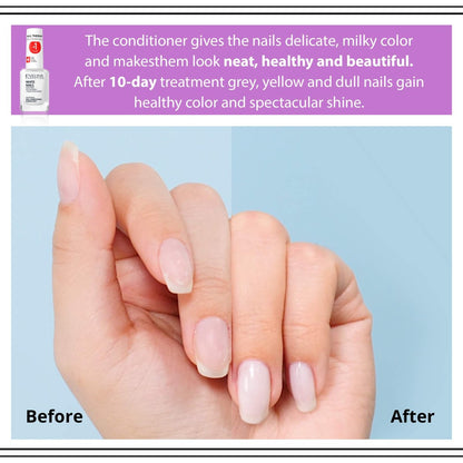 Eveline Cosmetics 3 In 1 Instantly Whiter Nail Whitener – 0.41 Fl Oz