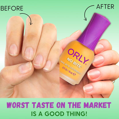 ORLY No Bite Nail Treatment – Stop Nail Biting with Bitter-Tasting Formula, Vegan & Non-Toxic, 0.6 oz