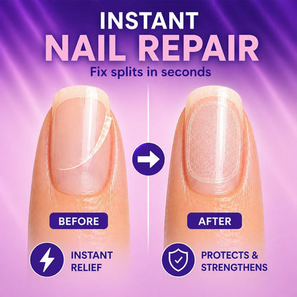 Finga-Nails Nail Repair Patches – Clear Self-Adhesive Broken Nail Patches for Chips, Splits & Split Fingernails – 32 Pre-Shaped Tabs Manicure Saver Kit
