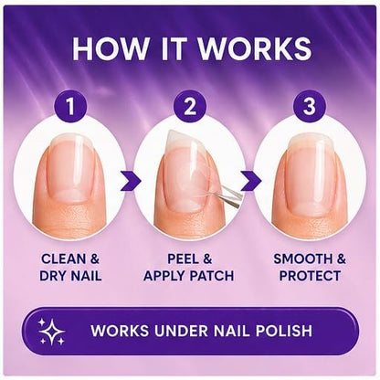 Finga-Nails Nail Repair Patches – Clear Self-Adhesive Broken Nail Patches for Chips, Splits & Split Fingernails – 32 Pre-Shaped Tabs Manicure Saver Kit