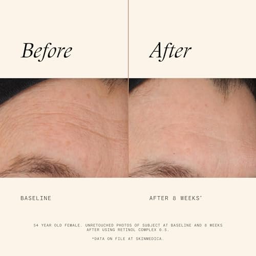 SkinMedica Retinol 0.5 Complex - Age-Defying Retinol Serum for Face, Reduces Fine Lines & Wrinkles, 1 Fl Oz Avelisse