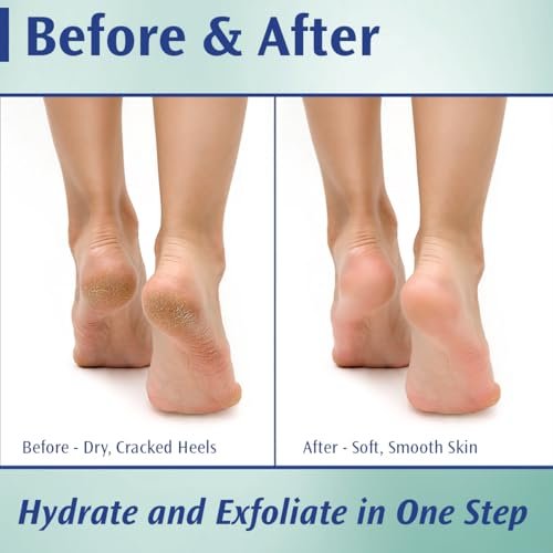 Pedifix Podiatrists' Choice 20% Urea Callus Control Extra Strength Foot Cream - 4 oz - Professional Treatment for Dry, Cracked Feet & Callus Relief Avelisse