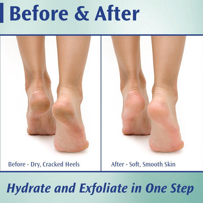 Pedifix Podiatrists' Choice 20% Urea Callus Control Extra Strength Foot Cream - 4 oz - Professional Treatment for Dry, Cracked Feet & Callus Relief Avelisse